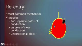 Hospital basic - EKG - tachycardia - 한일병원 하철민 선생님