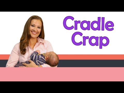 how to get rid of cradle cap uk