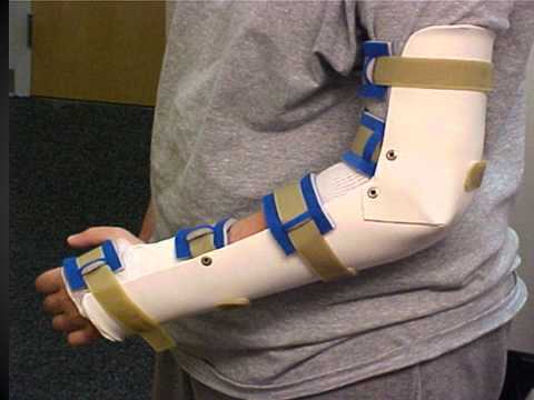 how to treat a torn tfcc