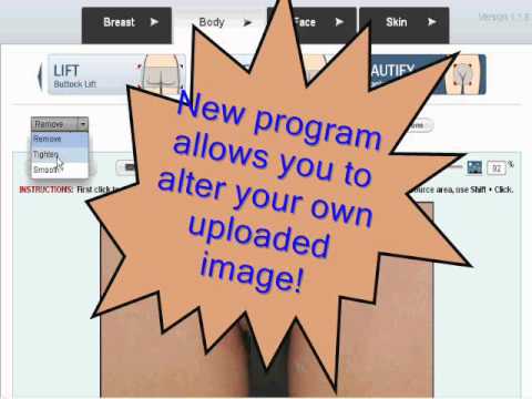 how to perform your own labiaplasty