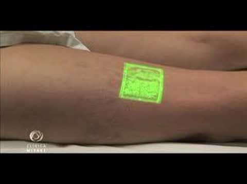 how to treat air embolism