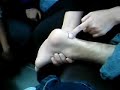 ?????-??-traction.medial.lateral