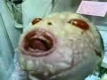 Harlequin type Ichthyosis