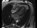 Robert Russo, M.D., Ph.D., director of the Cardiac MRI Program as well as the Intravascular Imaging Program at Scripps Clinic, is dedicated to clinical excellence, physician and fellowship education, and clinical and basic science research.
