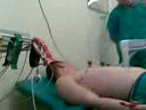EKG