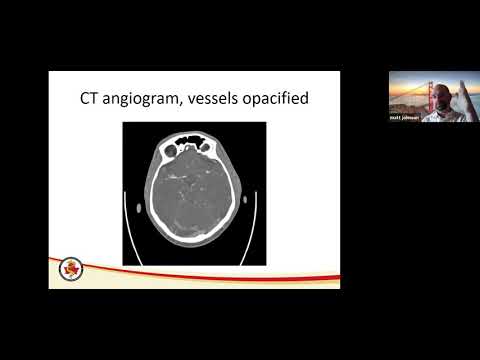 CTs: Neuroaxis Review of the Head & Spine