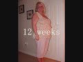 My pregnancy timeline