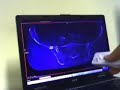 wii remote glovepie radiology report human interface device wiimote