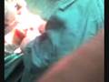 operac. Rodilla.wmv