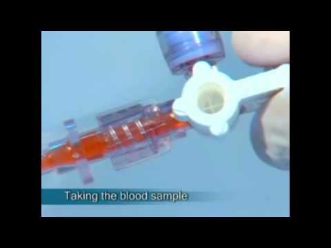 how to drain nephrostomy tube