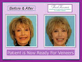 Adult Orthodontics Adult Orthodontics