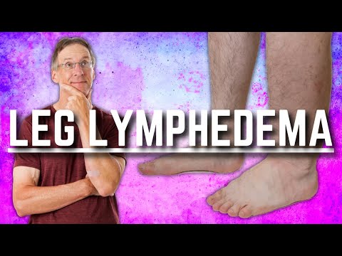how to assess edema in legs