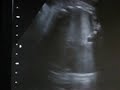 MVI_4150.AVI
