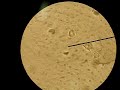 Giardia Lamblia