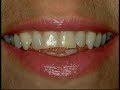 Odontologia Cosm�tica