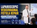 Laparoscopic Vesico Vaginal Fistula Repair