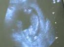 Kicking Baby In The Belly
