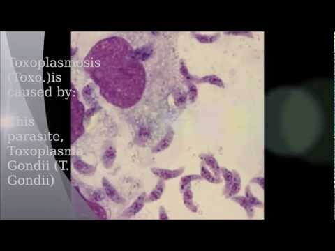 how to treat t gondii