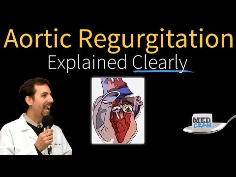 how to treat aortic valve regurgitation