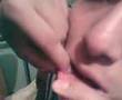 perforasion de spok THC