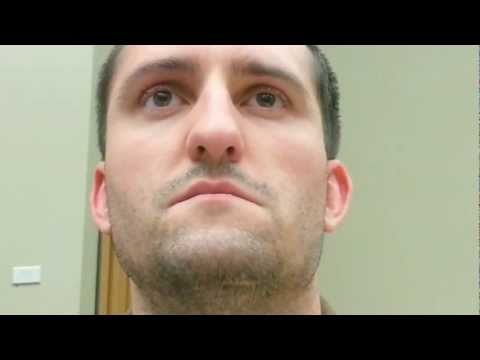 how to perform hirschberg test