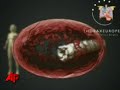 Breakthrough Windpipe Transplant Uses Stem Cells