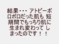 アトピーアレルギー皮膚炎の最短パーフェクト治療法