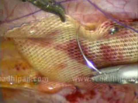 See video