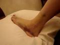 torn ligament update -- more fun than i can stand