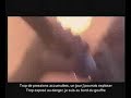Kery James - En feu de détresse Live au Bataclan Sous-titré