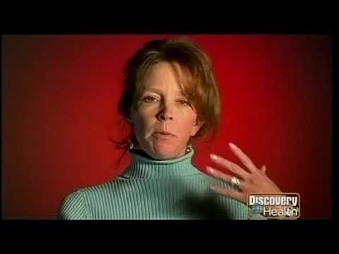 how to celiac disease test