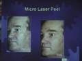 videos de Advances in Facial Rejuvenation - Laser