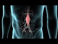 Endovascular Abdominal Aortic Aneurysm Repair (AAA Repair)