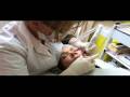 Semi-Permanent Lip Procedures