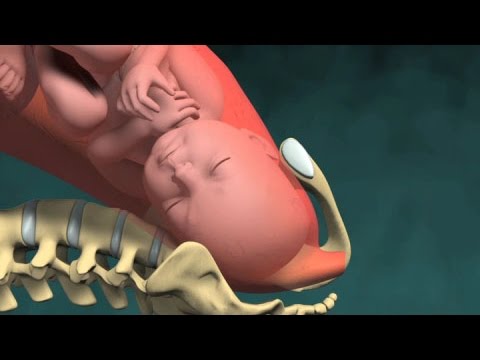 El nacimiento de un Bebé en 3D