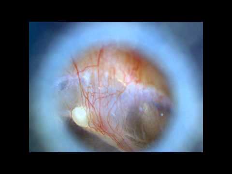 USB VIDEO OTOSCOPE OTOSKOP AURISCOPE EAR SCOPE CAMERA