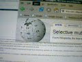 Selective Mutism