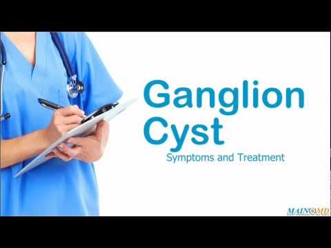 how to treat ganglion cyst