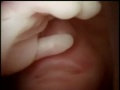 Prolife Advert