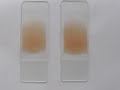 Peripheral blood smear Blood Smear