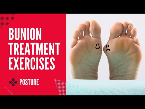 how to cure bunions