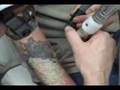 Tattoo removal: Exeter St Mellion, Plymouth, Dorset, Somerset, Bristol, Devon and Cornwall