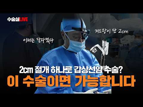  2cm 절개 하나로 갑상선암 수술? '이 수술'이면 가능합니다 (갑상선암 로..