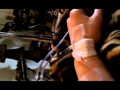 how to administer ivig