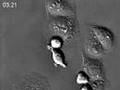 Interactions between fibroblasts and epithelial cells