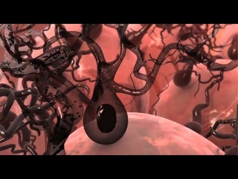Melanoma: the Dangers, Facts, and a Visionary Solution