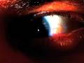 VITREOUS HUMOR