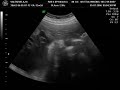 my first baby ultrasound my first baby ultrasound