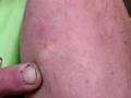 Alien Implant