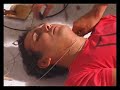 Skitzo Dancer Part 1 - Making Of